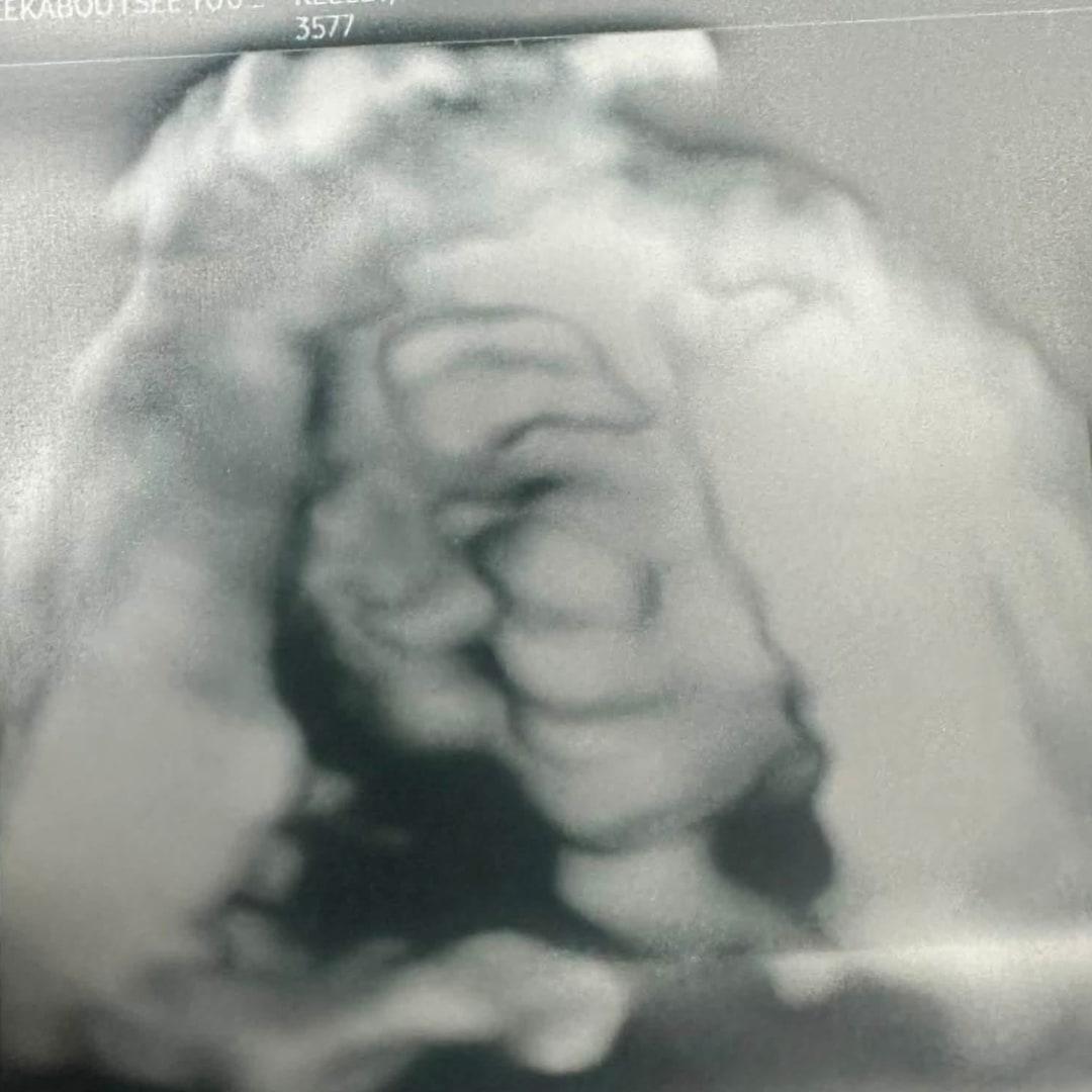 Photo shared by Allison for their Babylist baby registry.