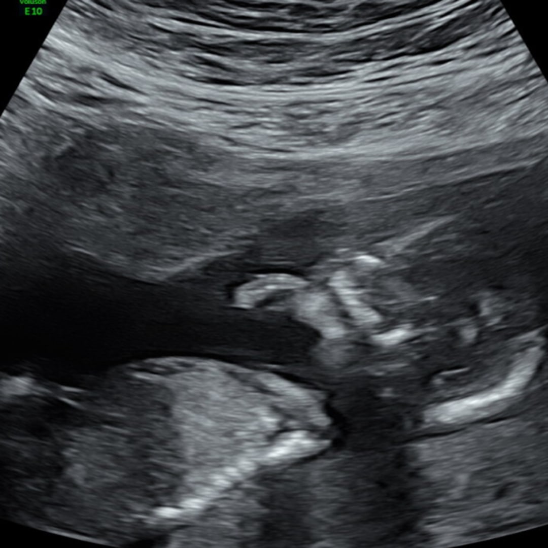 Photo shared by Nicole for their Babylist baby registry.