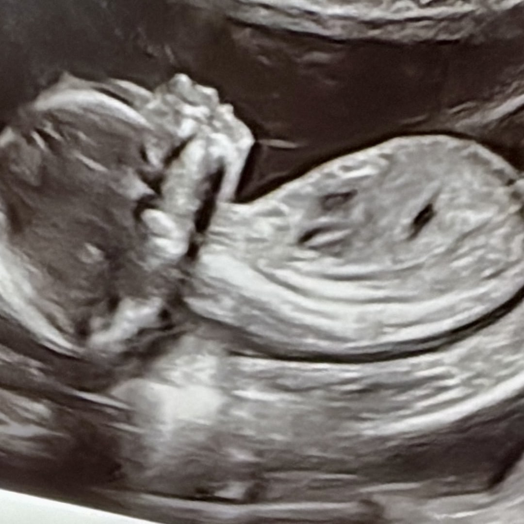 Photo shared by Jemimah for their Babylist baby registry.