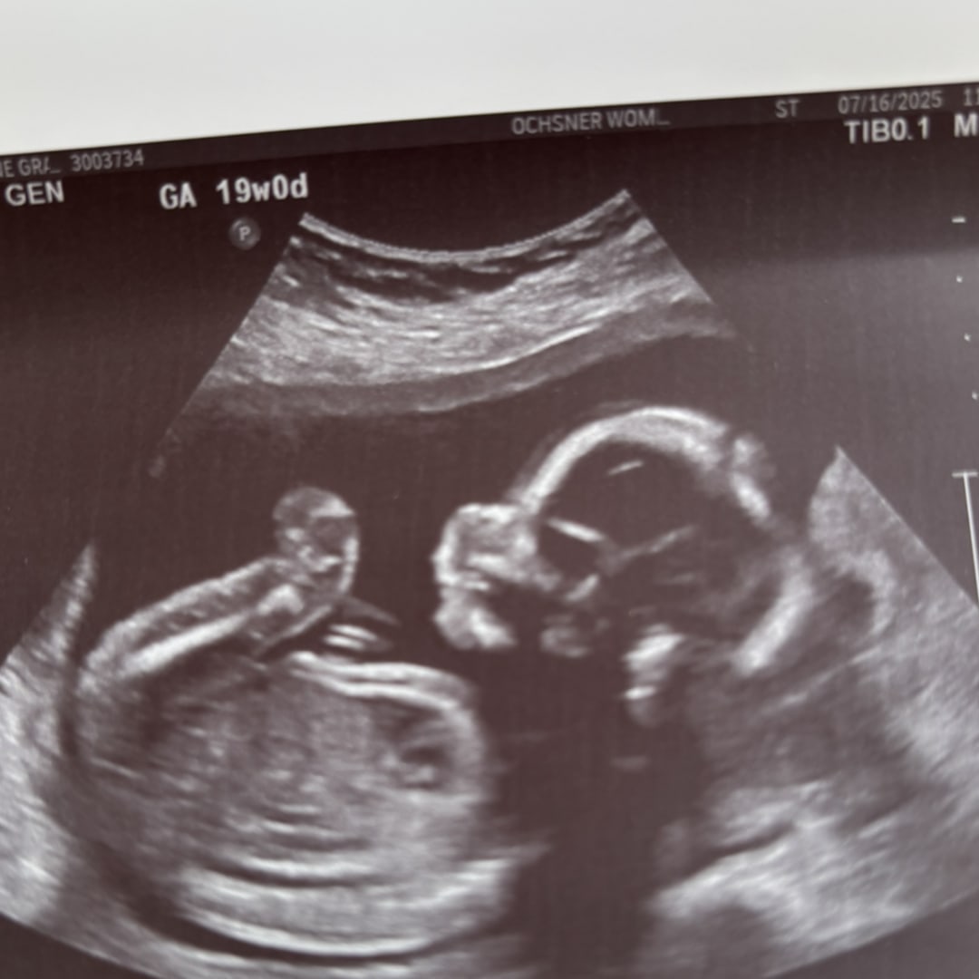 Photo shared by Madeline for their Babylist baby registry.