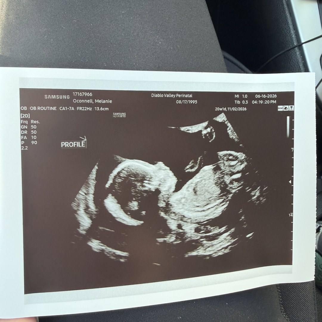 Photo shared by Melanie for their Babylist baby registry.