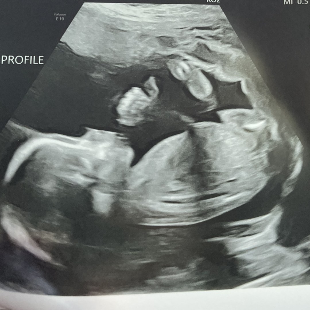 Photo shared by Samantha for their Babylist baby registry.