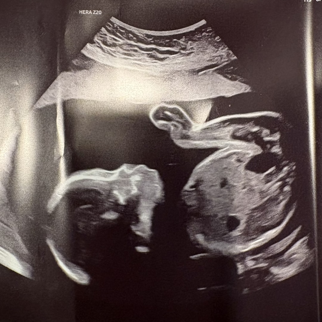 Photo shared by Caitlin for their Babylist baby registry.