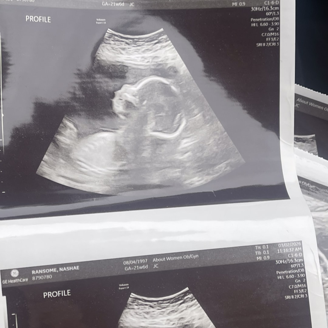 Photo shared by Nashae for their Babylist baby registry.