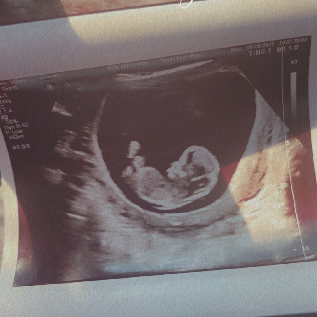 Photo shared by Shimic for their Babylist baby registry.