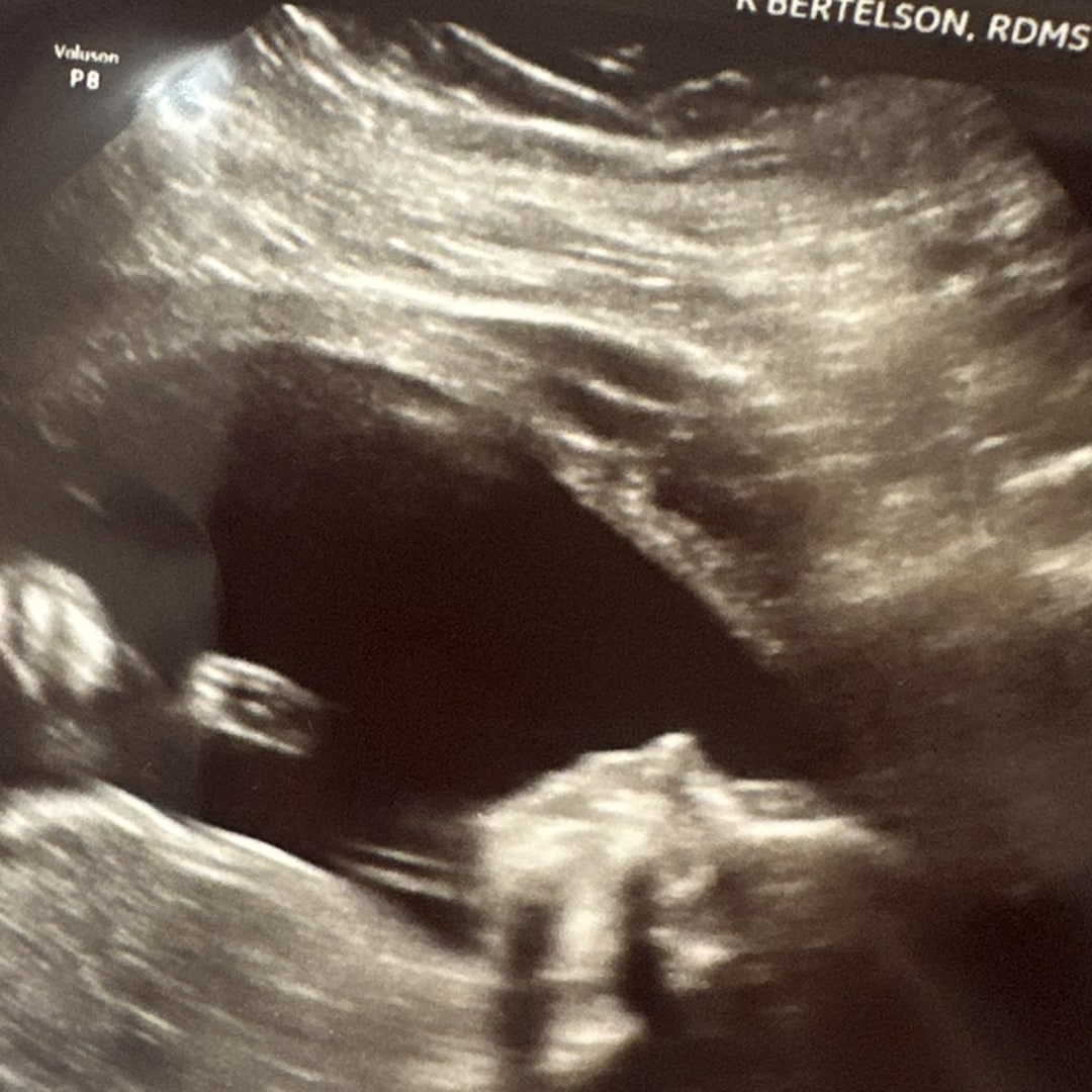 Photo shared by Milly for their Babylist baby registry.