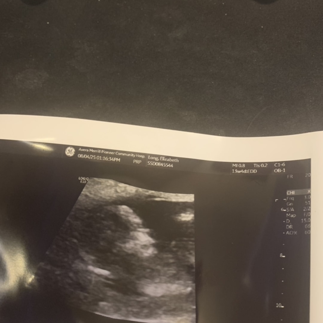 Photo shared by Elizabeth for their Babylist baby registry.