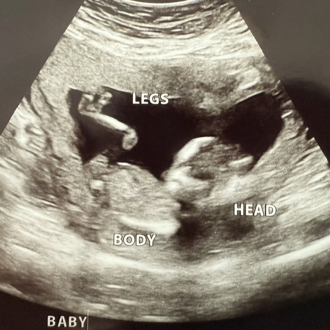 Photo shared by Rebecca for their Babylist baby registry.