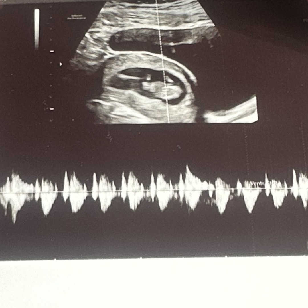 Photo shared by Jordyn for their Babylist baby registry.