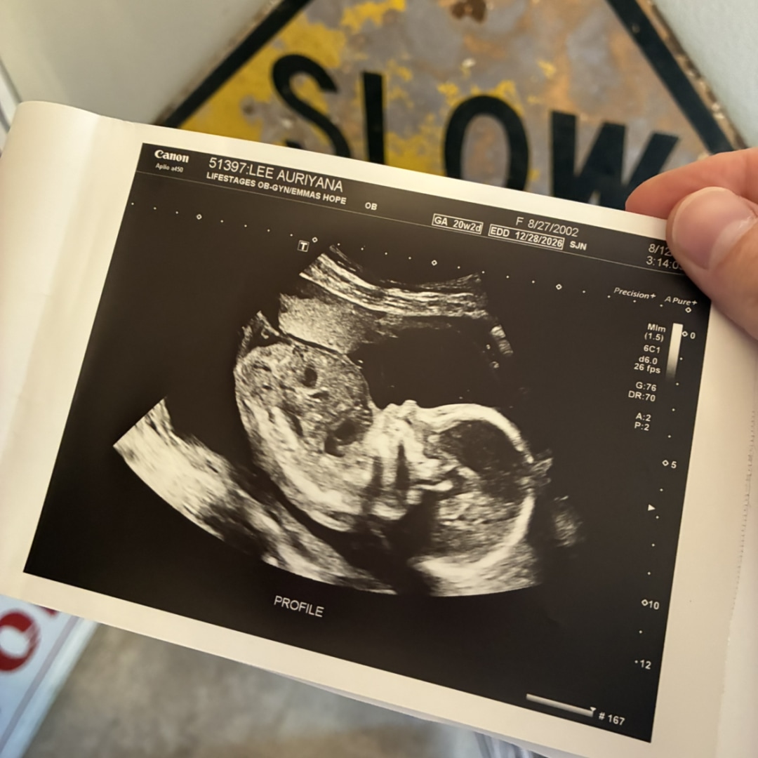 Photo shared by Auriyana for their Babylist baby registry.