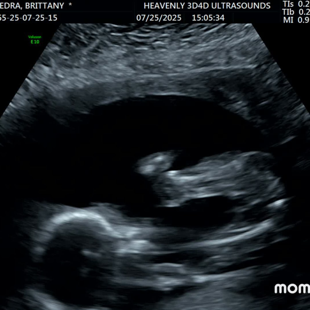 Photo shared by Brittany for their Babylist baby registry.