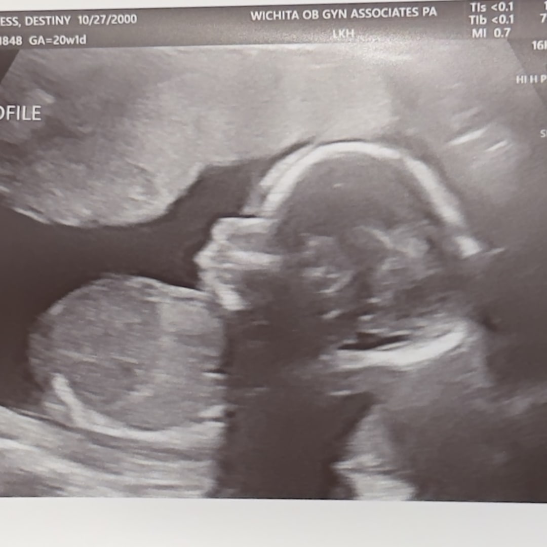 Photo shared by Destiny for their Babylist baby registry.