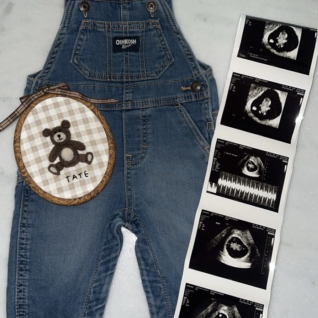 Photo shared by Hannah for their Babylist baby registry.