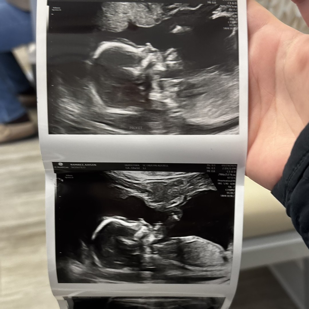 Photo shared by Kaylen for their Babylist baby registry.