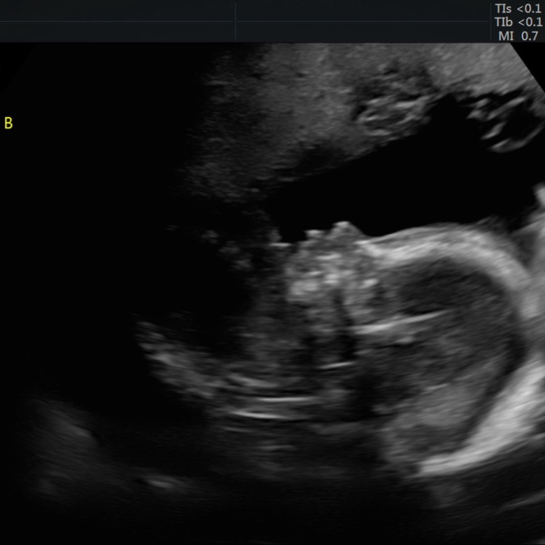Photo shared by Alexa for their Babylist baby registry.