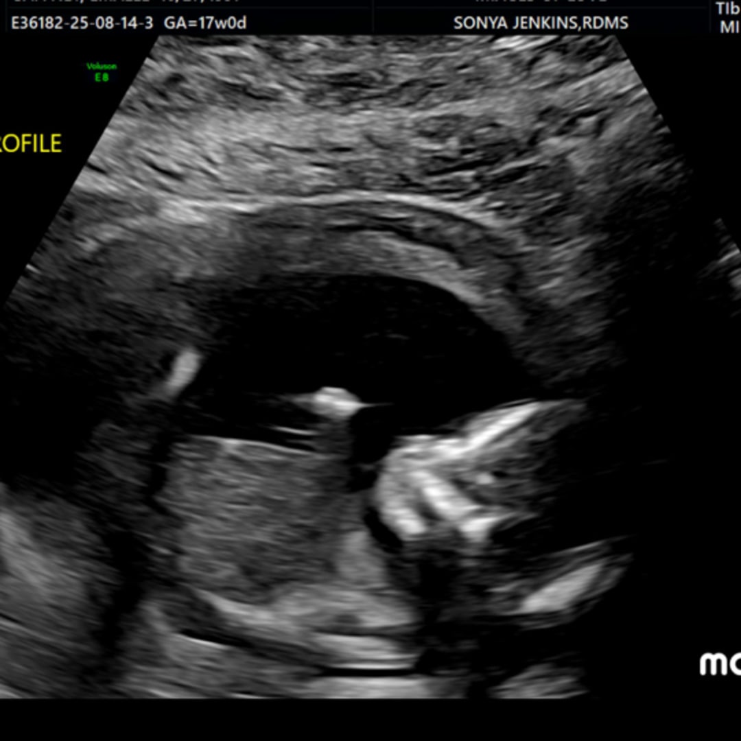 Photo shared by Emalee for their Babylist baby registry.