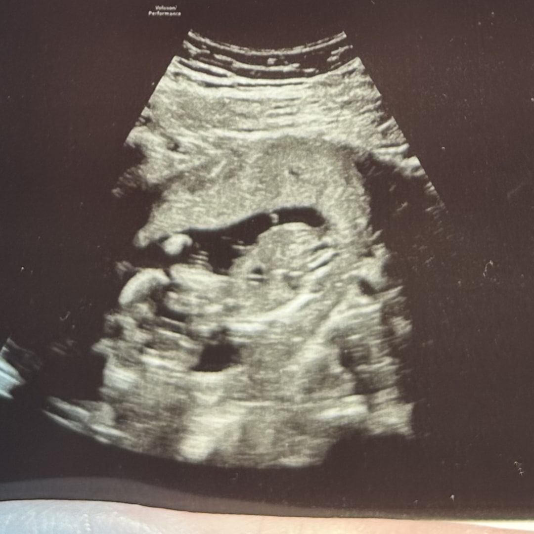 Photo shared by Jordyn for their Babylist baby registry.