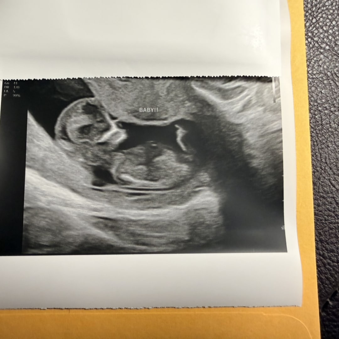 Photo shared by Dayna for their Babylist baby registry.