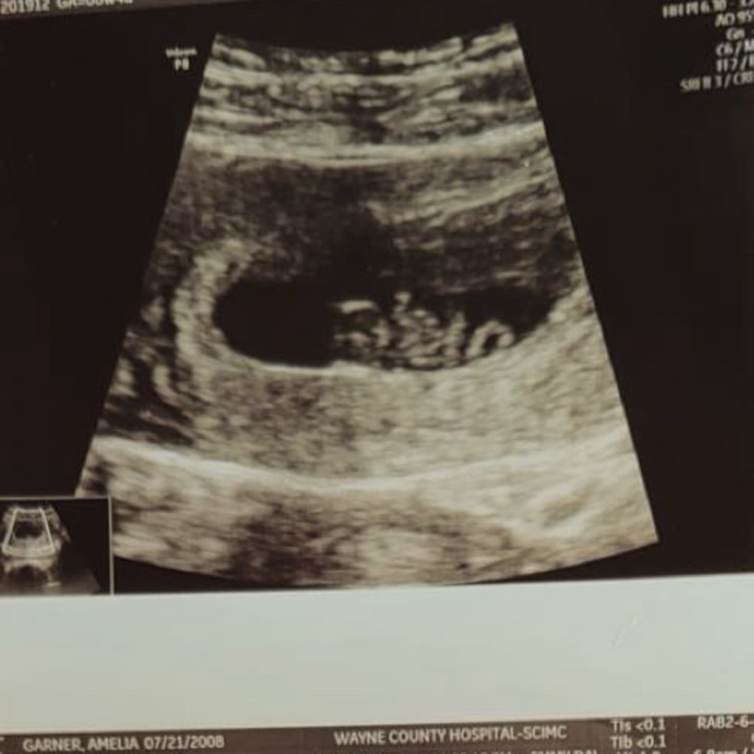 Photo shared by Amelia for their Babylist baby registry.