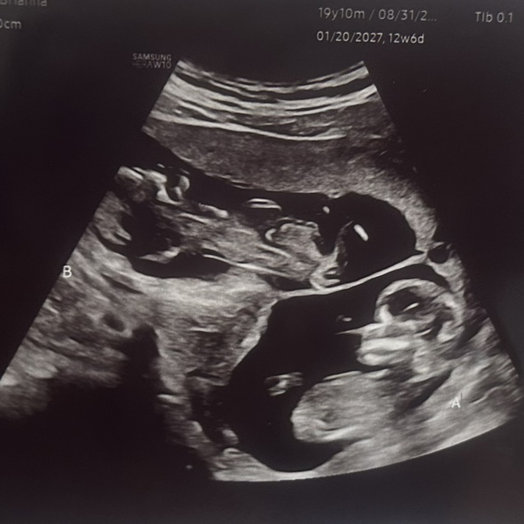 Photo shared by Bri for their Babylist baby registry.