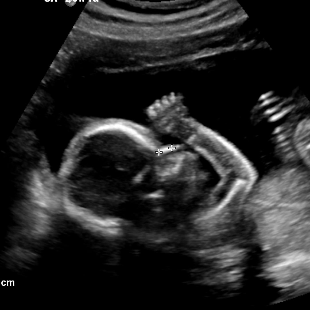 Photo shared by Allie for their Babylist baby registry.
