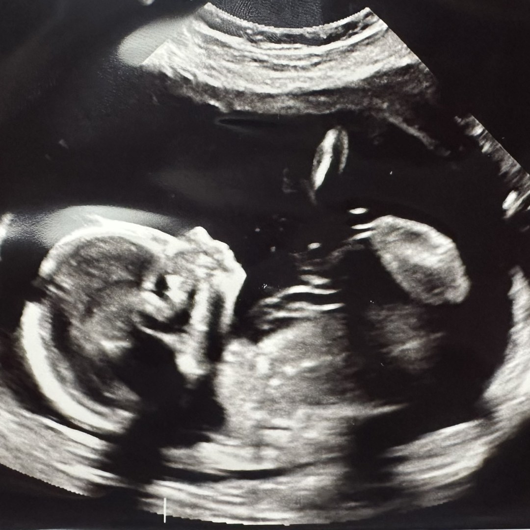 Photo shared by Anna Grace for their Babylist baby registry.
