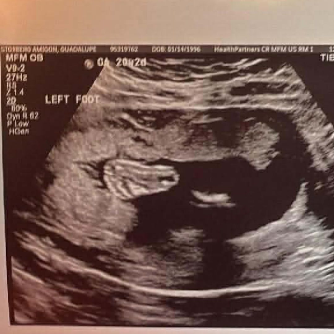 Photo shared by Lupe for their Babylist baby registry.