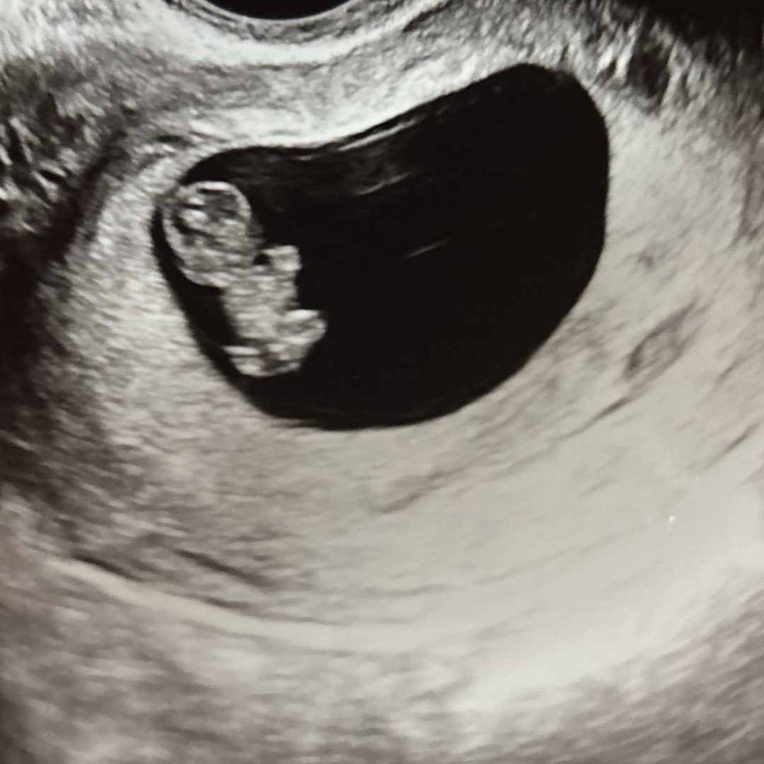 Photo shared by Andrea for their Babylist baby registry.