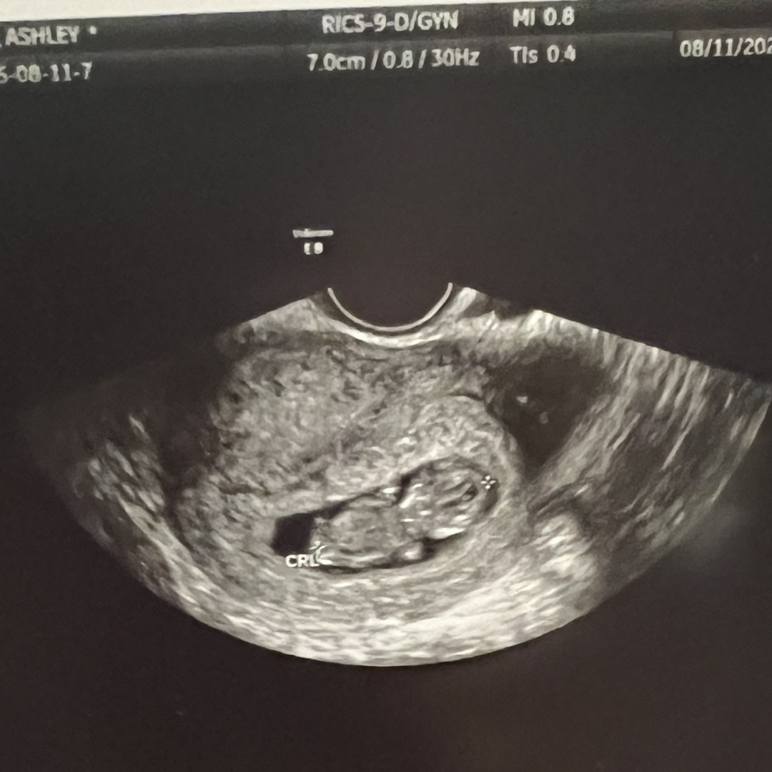 Photo shared by Ashley for their Babylist baby registry.