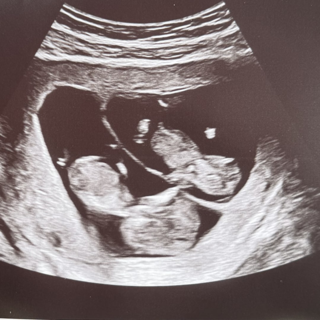 Photo shared by Ashley for their Babylist baby registry.