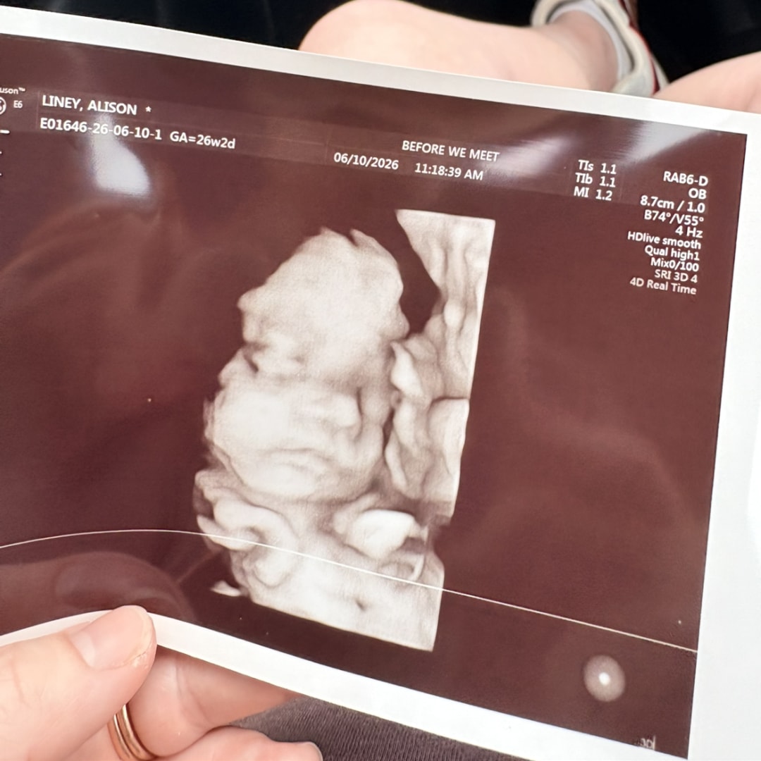Photo shared by Alison for their Babylist baby registry.