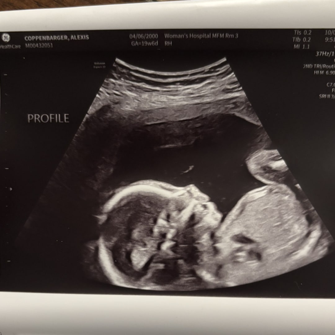 Photo shared by Alexis for their Babylist baby registry.