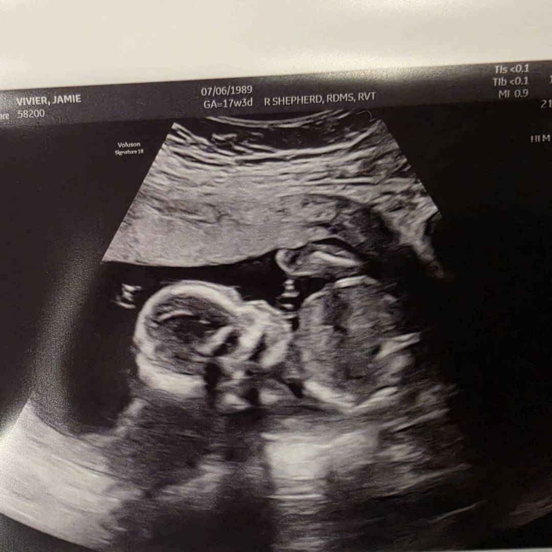Photo shared by Jamie for their Babylist baby registry.