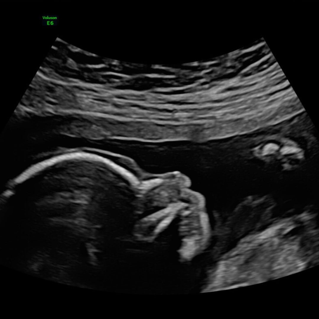 Photo shared by Malaina for their Babylist baby registry.