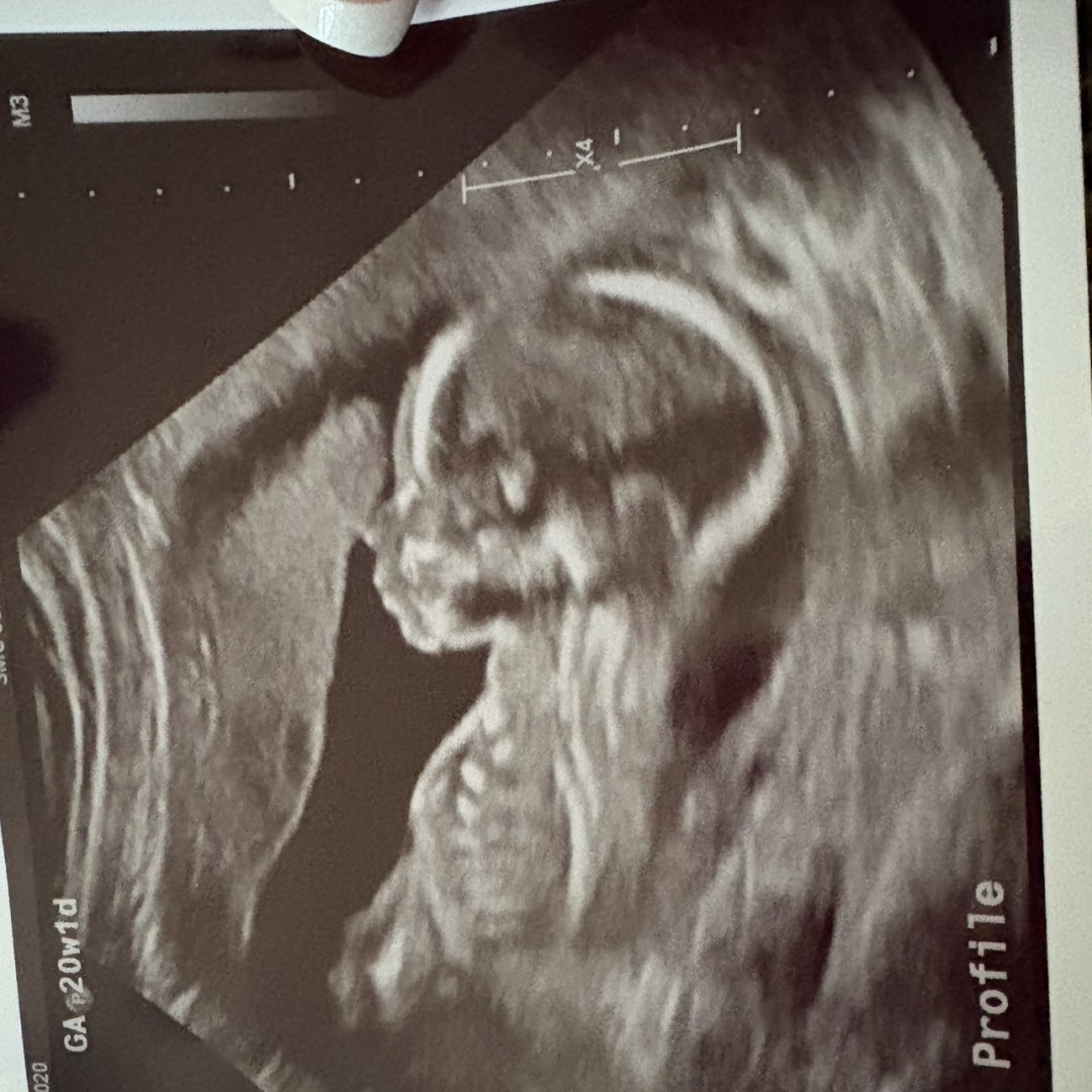 Photo shared by Baylie for their Babylist baby registry.
