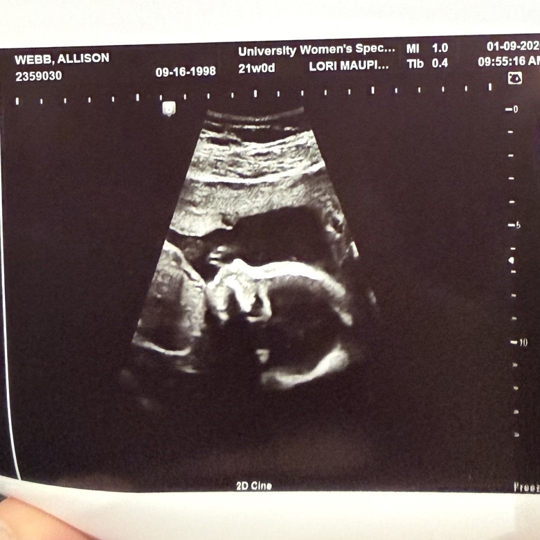 Photo shared by Allison for their Babylist baby registry.