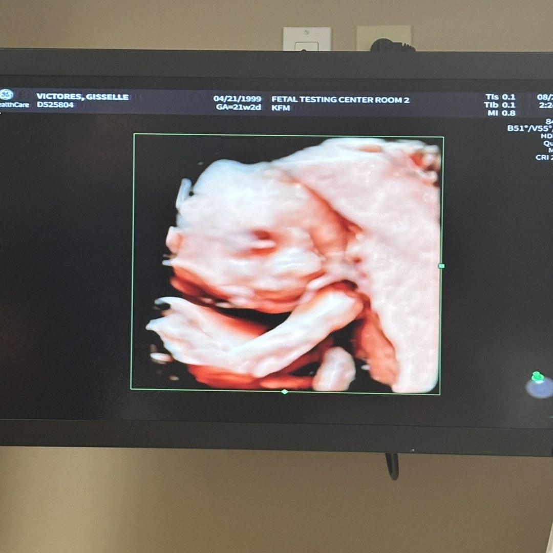 Photo shared by Gisselle for their Babylist baby registry.