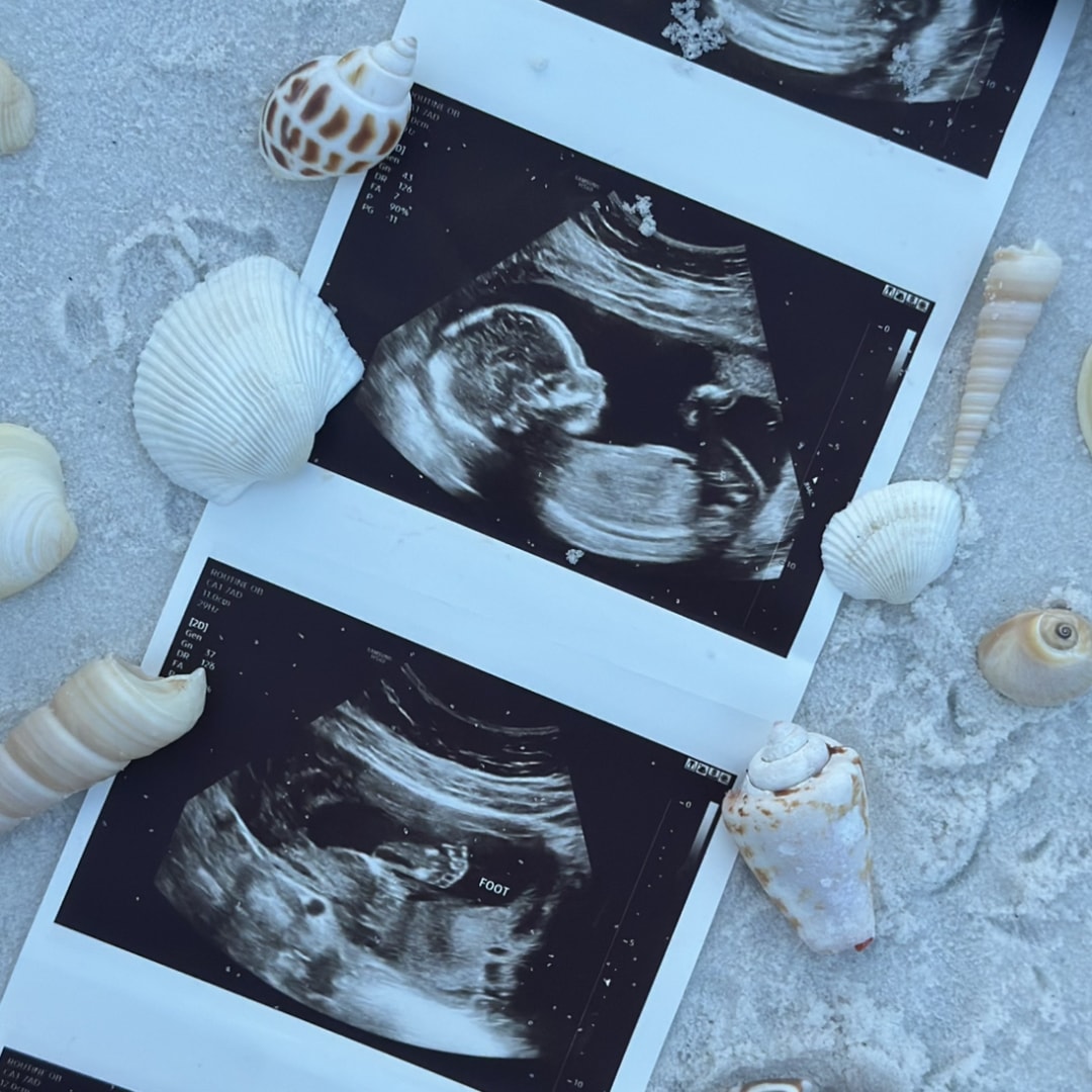 Photo shared by Valerie for their Babylist baby registry.
