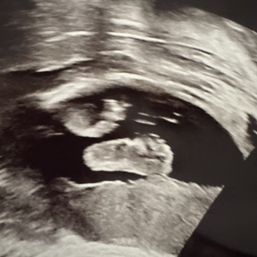 Photo shared by Cinthia for their Babylist baby registry.