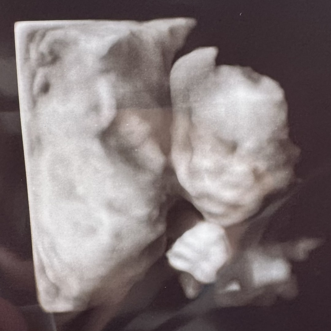Photo shared by Hannah for their Babylist baby registry.