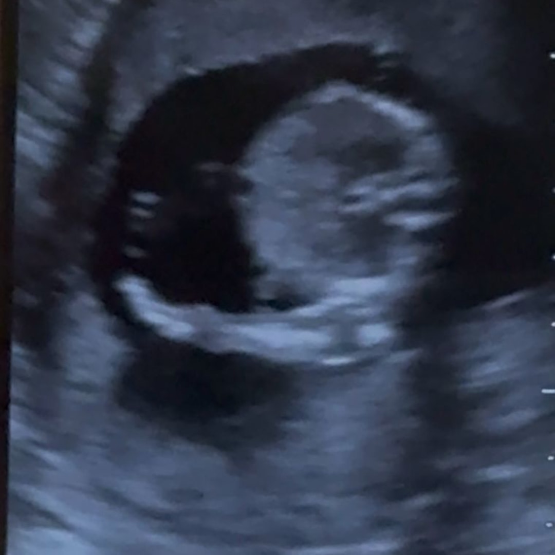 Photo shared by Koke for their Babylist baby registry.
