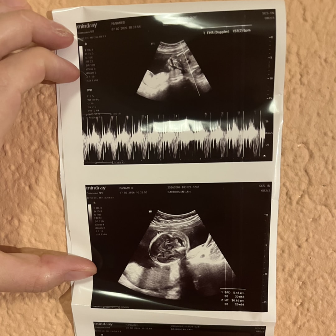 Photo shared by Megan for their Babylist baby registry.