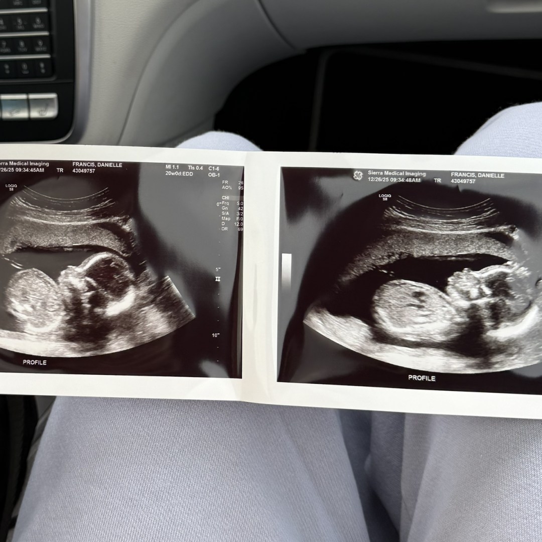 Photo shared by Danielle for their Babylist baby registry.