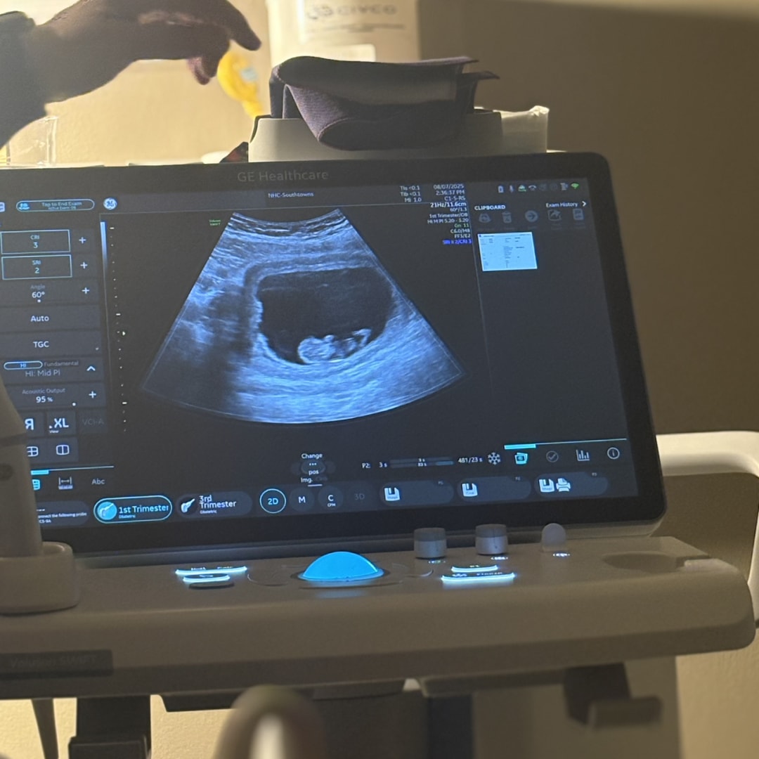 Photo shared by Calvina for their Babylist baby registry.
