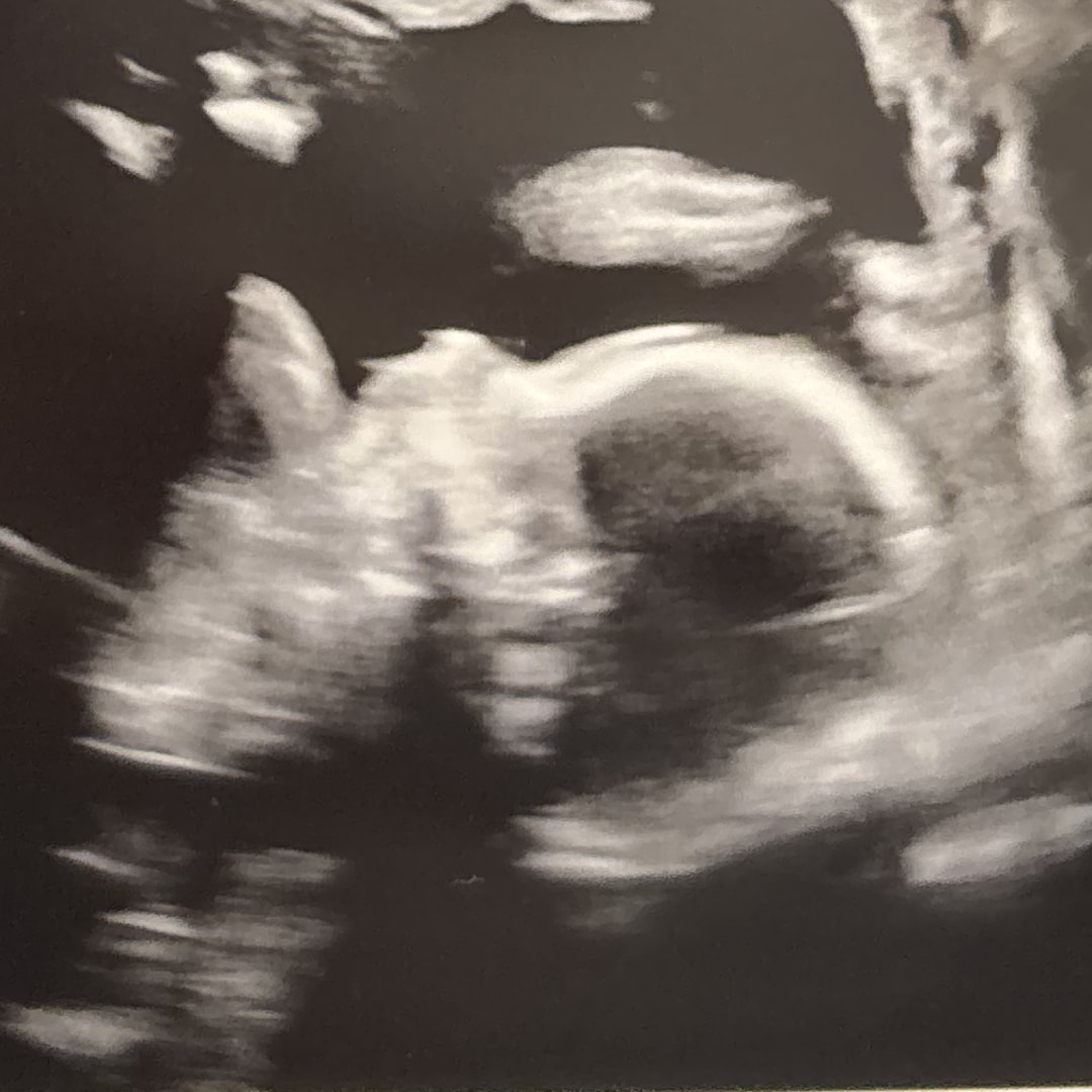 Photo shared by Gaelin for their Babylist baby registry.