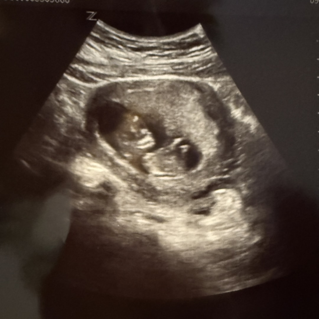 Photo shared by Cindy for their Babylist baby registry.