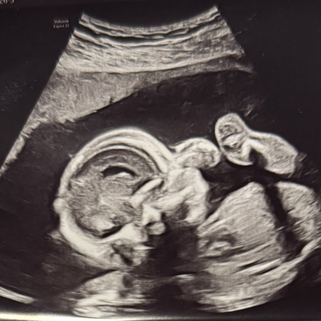 Photo shared by Alayna for their Babylist baby registry.