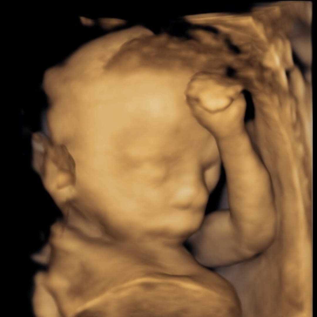 Photo shared by Makayla for their Babylist baby registry.