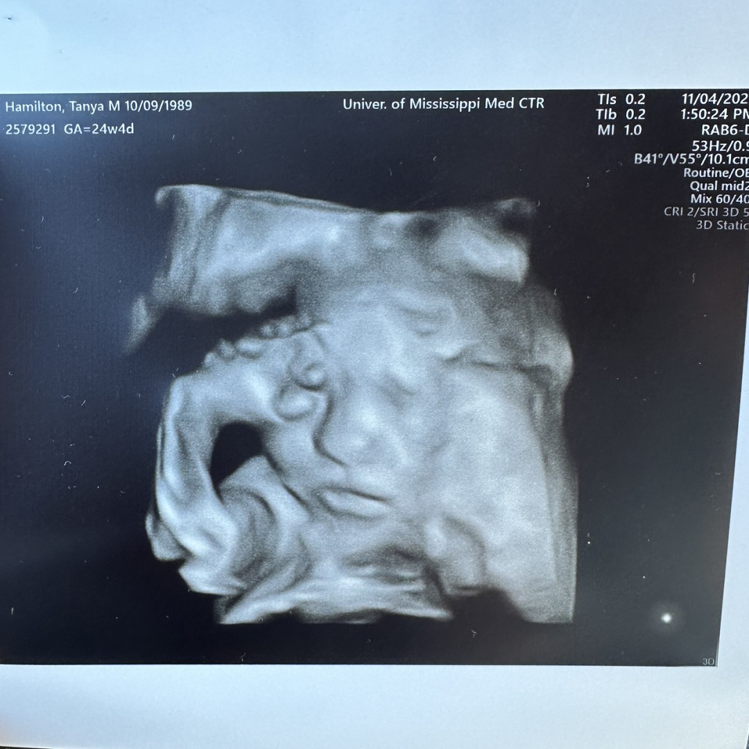 Photo shared by Tanya for their Babylist baby registry.