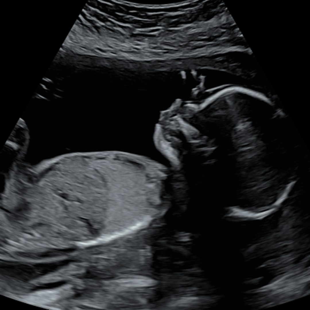 Photo shared by Deja Oriana for their Babylist baby registry.
